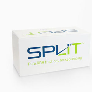 RNA Extraction and cDNA Amplification